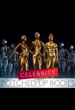 Poster for Celebrity Botched Up Bodies