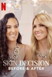 Poster for Skin Decision: Before and After