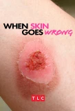 Poster for When Skin Goes Wrong
