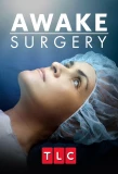 Poster for Awake Surgery